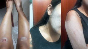 horror: denuncio que un hombre le puso una cuerda en el cuello e intento secuestrarla 