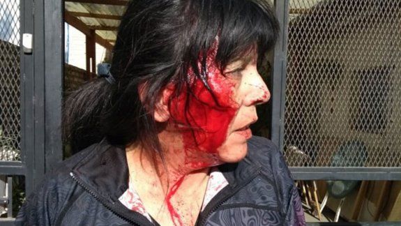 Formularon cargos a Pucará Vidal por una brutal golpiza