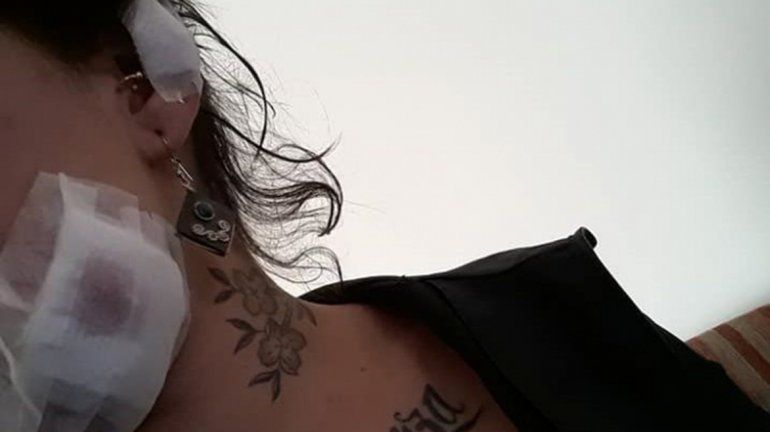 La atacaron con una botella por llevar el pañuelo verde