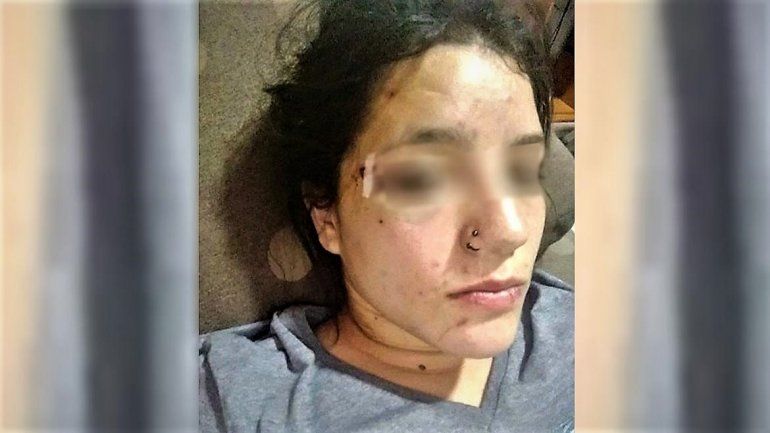 La atacaron brutalmente afuera de un boliche y le rompieron la cabeza a zapatazos