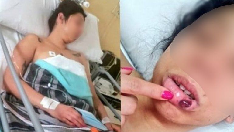 Atacó salvajemente a una mujer y está libre