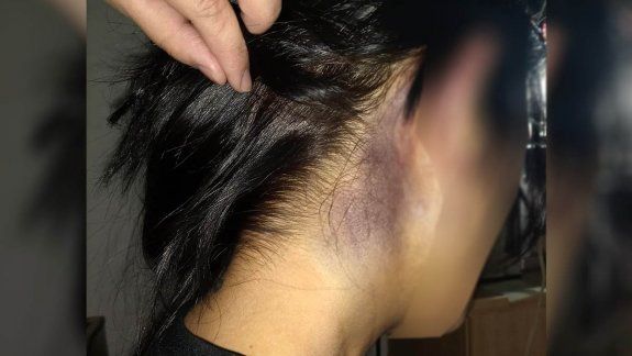 Desfiguró a su pareja a golpes: es un ex policía