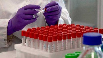 diez pacientes con covid-19 se tratan con suero equino