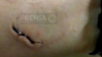 choco, se nego a realizar el alcotest y mordio a un policia choco, se nego a realizar el alcotest y mordio a un policia