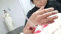 Una vecina de Río Gallegos, gravemente herida por un pitbull.
