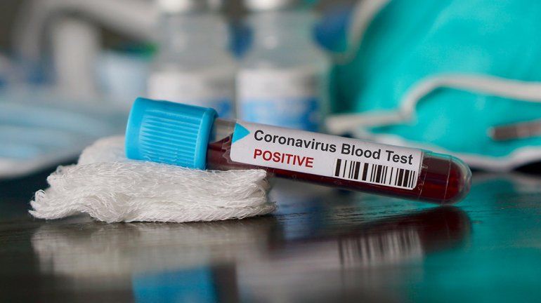 Confirman que en una clínica de Roca hay 9 trabajadores con coronavirus