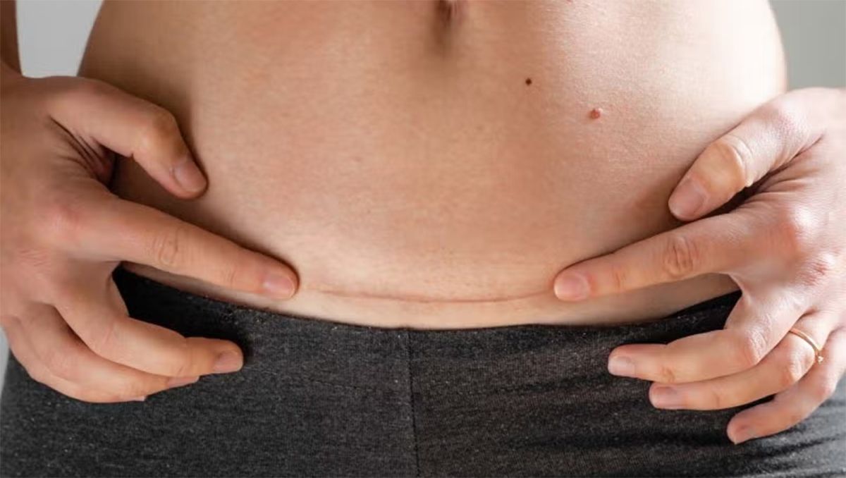 Condenaron a una clínica privada y a un anestesista por violencia obstétrica