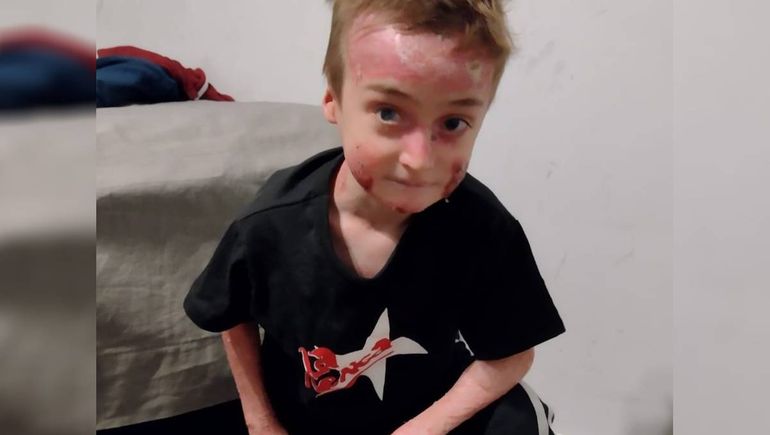 Caso único en Río Negro: la lucha de Noah y la conmovedora solidaridad