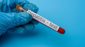 Hepatitis aguda infantil: detectan el primer caso en el país