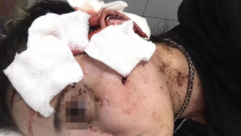 desfiguro con un vaso a una moza, pero no ira preso