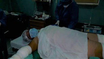 una jauria ataco gravemente a una marinera: me querian comer