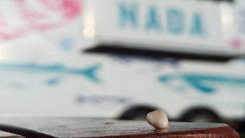 viral: encontremos a la nina y que recupere su diente de leche