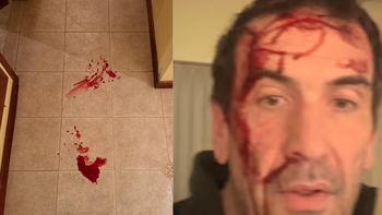 violento robo a pablo cervi: por que la justicia decidio unificar la causa con otros asaltos