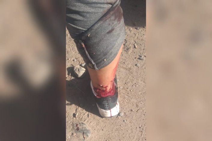 Terrible: un perro atacó a una mujer y su dueño efectuó varios disparos