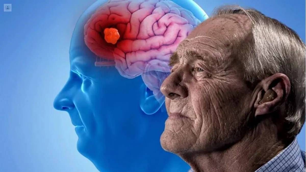 Descubren una proteína con efectos protectores contra el Alzheimer