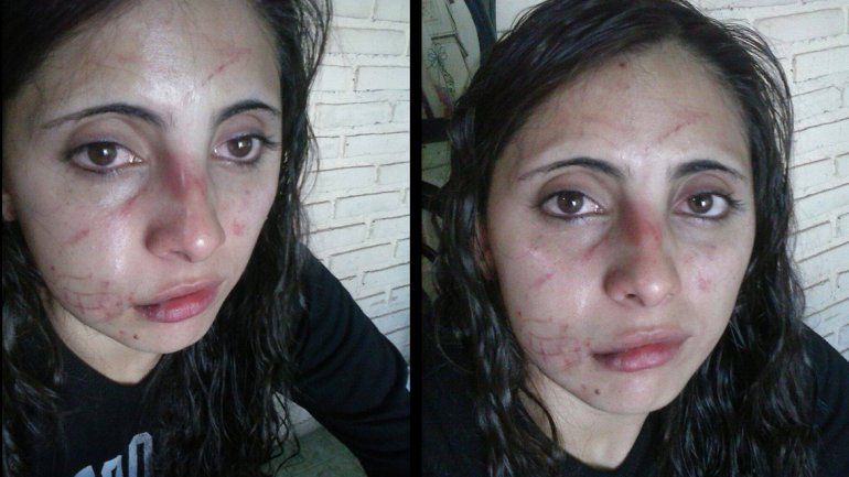 Fabiana fue agredida ferozmente por un grupo de personas.