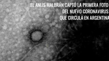 el instituto malbran logro fotografiar la cepa del coronavirus argentino