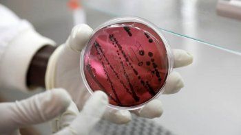 bolivia: un virus similar al ebola alarma a los cientificos