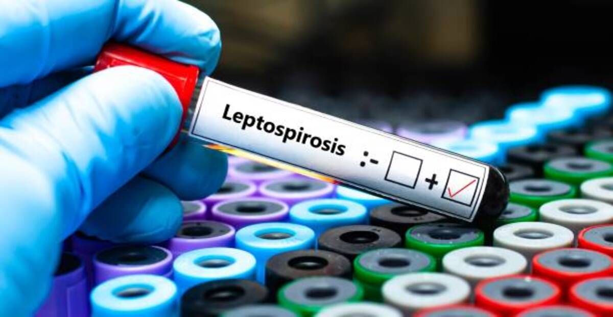 El ministerio de Salud investiga posibles casos de leptospirosis.