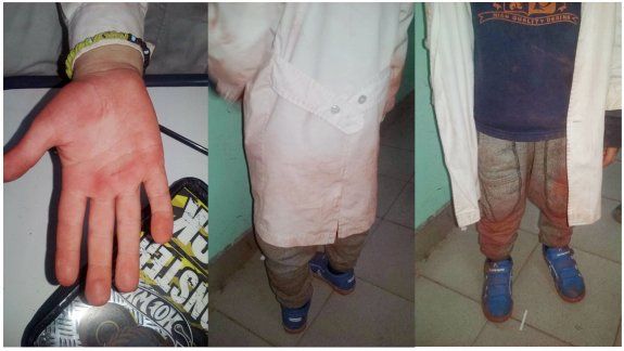 Así quedaron los guardapolvos por el polvillo que se volatilizó por toda la escuela