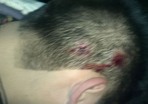 Cuestionaron procedimiento policial