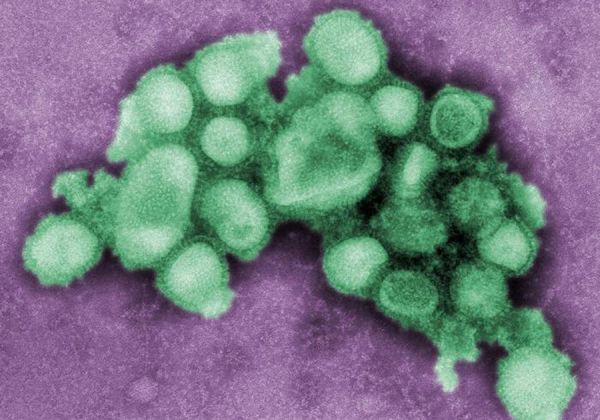 El INTA avanza en la secuenciación del virus H1N1