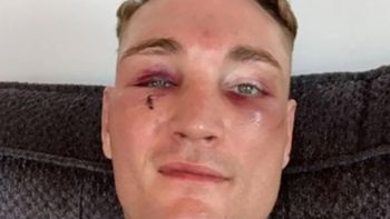 desfiguro a su rival, le robaron la pelea y ahora peralta tendra revancha